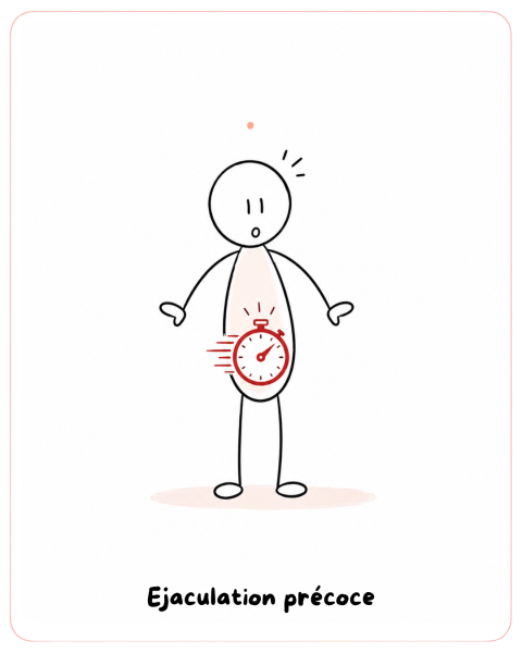 Ejaculation Precoce