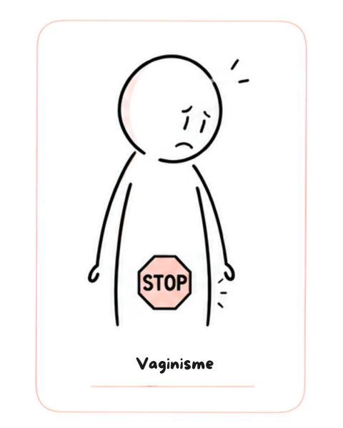 Vaginisme